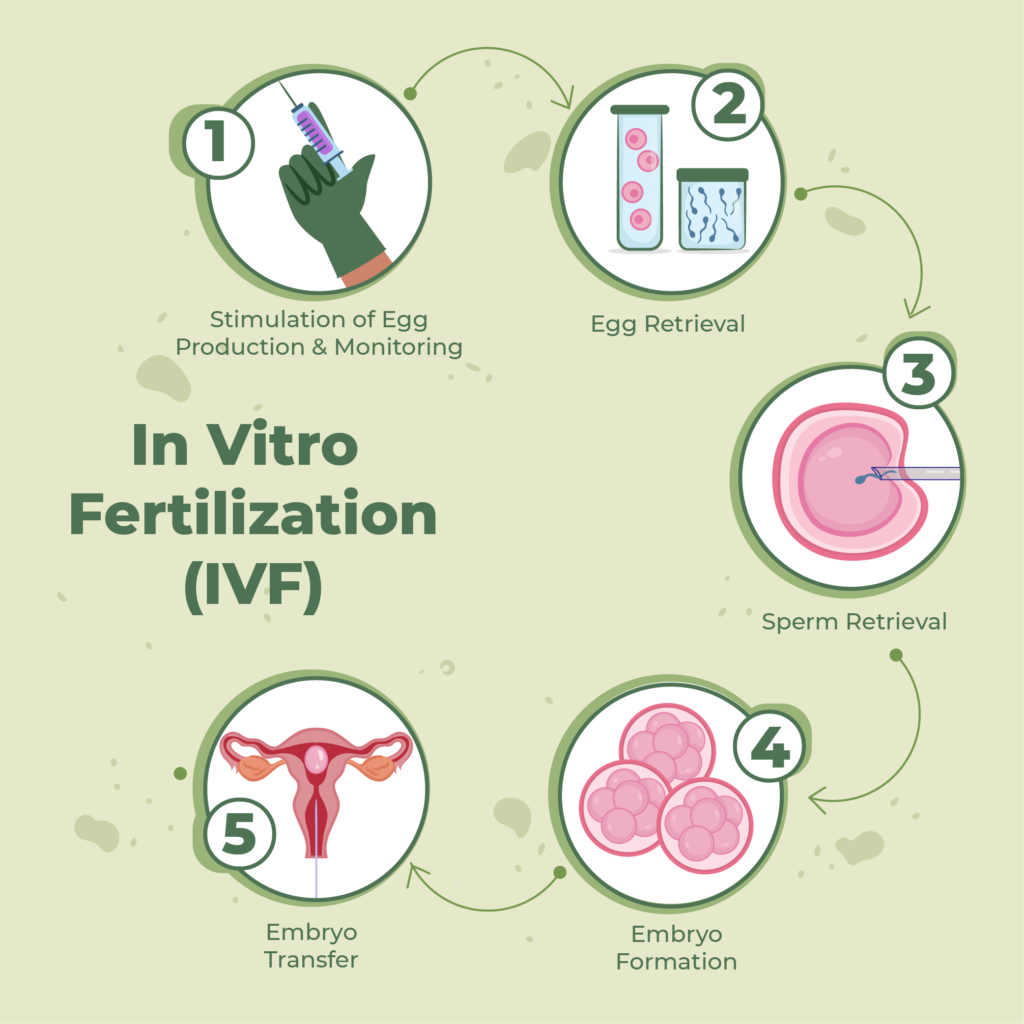Ivf Process Step By Step Egg Retrieval Ivf Process Step By Step Egg Retrieval
